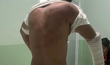 Homem é sequestrado e espancado por dívida de R$ 100 em MT