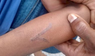 Pecuarista marca criança indígena com ferro quente na divisa de MT